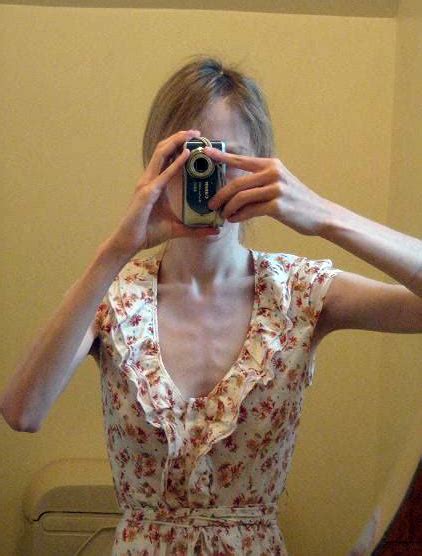 anorexic porn|Anorexic